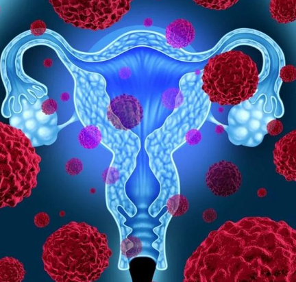 للنساء فقط.. أعراض تنذرك بالإصابة بسرطان الرحم