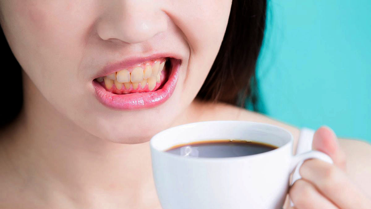 طبيب يحذر من مخاطر القهوة على الفم والأسنان