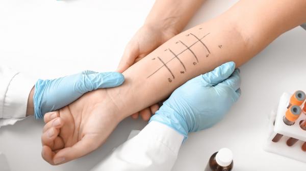 كل ما تحتاجين إلى معرفته حول اختبارات «حساسية الجلد»