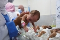 وفاة طفل بمستشفى كمال عدوان بسبب سوء التغذية
