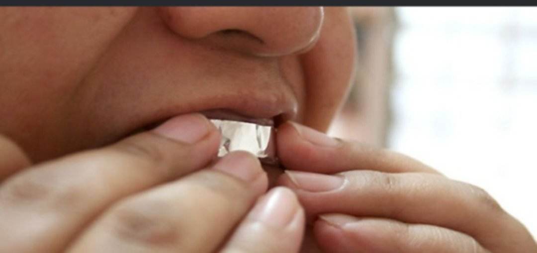 ماذا يحدث عند تغطية أسنانك بورق الألمنيوم لمدة ساعة؟