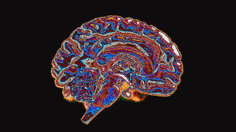 تقنية تصوير جديدة تكشف منطقة الدماغ الأكثر تضررا من كوفيد19