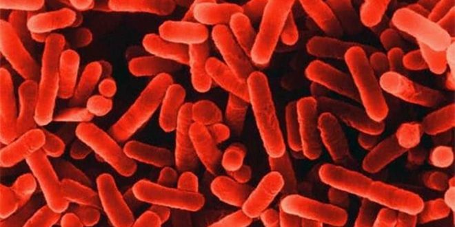 ثلاث وفيات و71 مصاباً ببكتيريا الفيلقية في بولندا